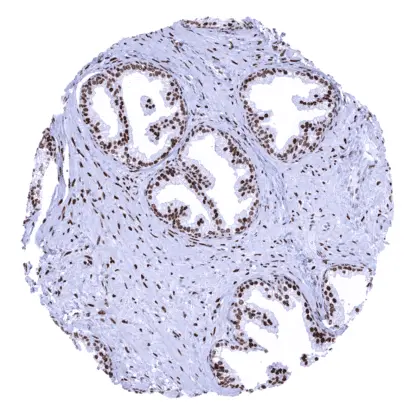 ACE2 (MSVA-919R) (0.1 mL)