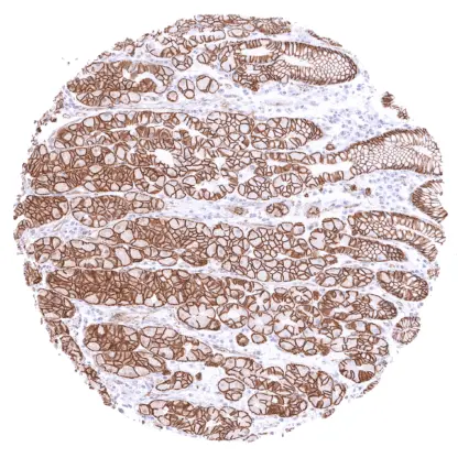 Beta-Catenin (MSVA-578R)