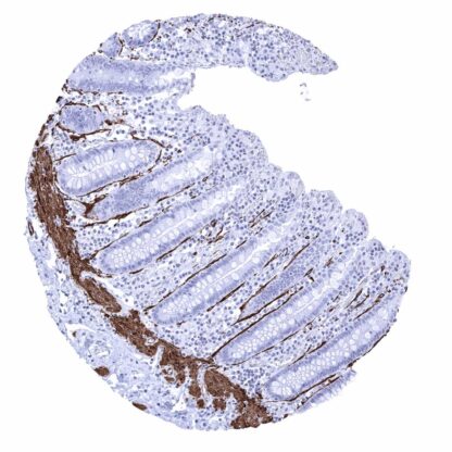 [sk1278] Caldesmon (MSVA-538R)