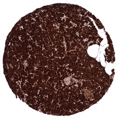 [sk1288] Carboxypeptidase A1 / CPA1 (MSVA-601M)