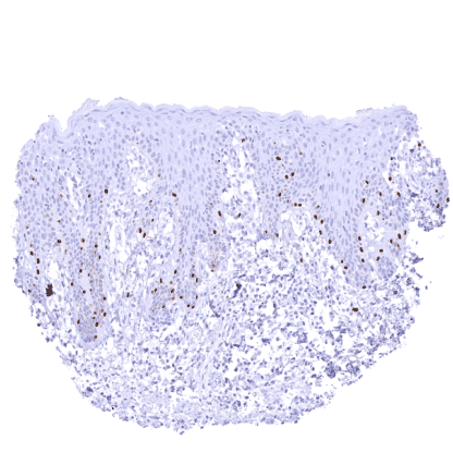 [sk1831] Steroidogenic acute regulatory (StAR) protein (MSVA-740R)