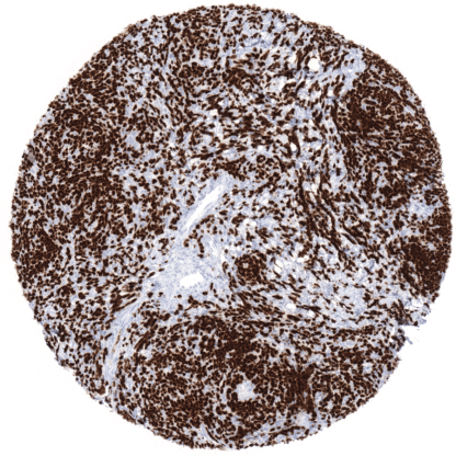 TFF1 / pS2 (MSVA-482M)