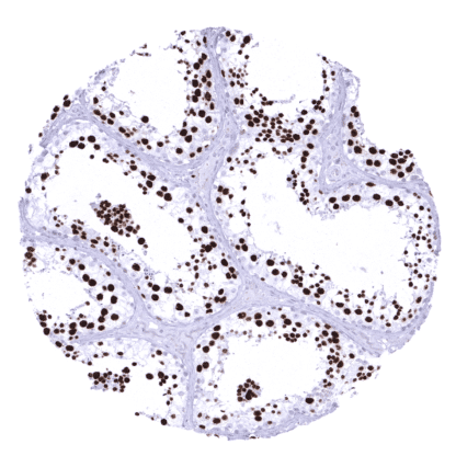 [sk1866] Topoisomerase 2-alpha / TOPO2A (MSVA-802R)