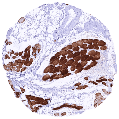 [sk1876] TRPS1 (MSVA-512R)