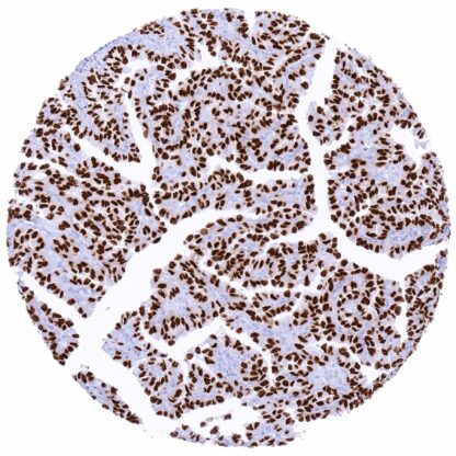 [sk1881] TTF-1 / Thyroid Transcription Factor 1 / NKX2-1 (MSVA-312R)