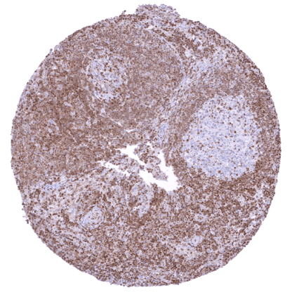 [sk1732] p27 / Kip1 (HMV3970)