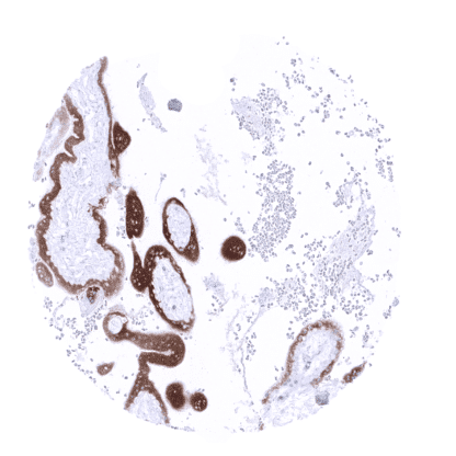 [sk1745] PAPP-A (MSVA-780M)