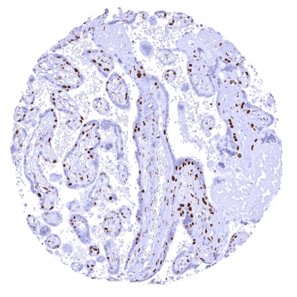 [sk1746] PARP1 (HMV334)