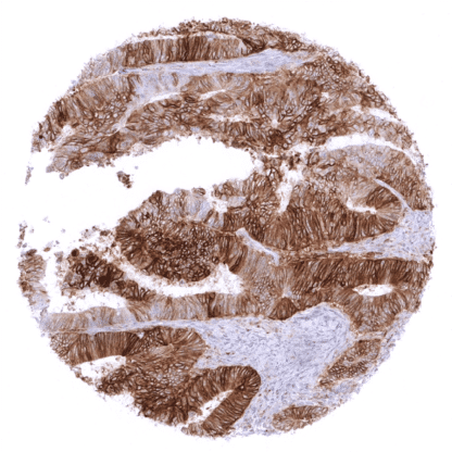 [sk1756] PD-L1 (MSVA-711R)