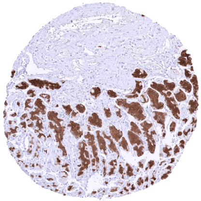 [sk1767] Pepsinogen I (HMV318)