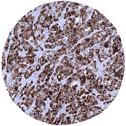 [sk1775] PMEL 17 / gp100 / Melanosome (MSVA-617R)