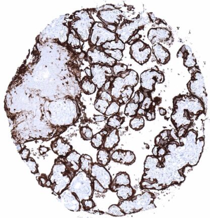 [sk1777] PLAP (MSVA-350R)