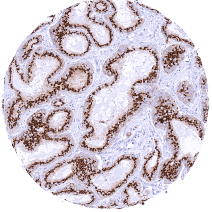 [sk1783] Prostein (MSVA-460R)