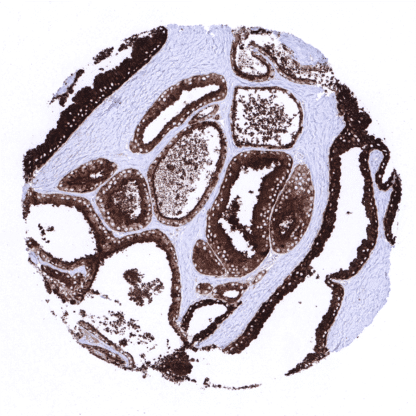 [sk1790] PSAP (MSVA-452M)