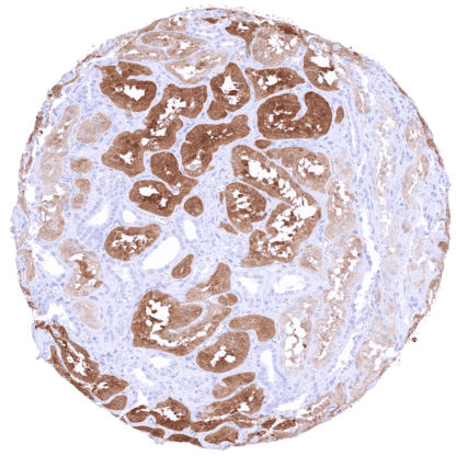 [sk1793] PSAT1 (HMV331)