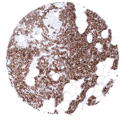 [sk1796] PTH (MSVA-525R)