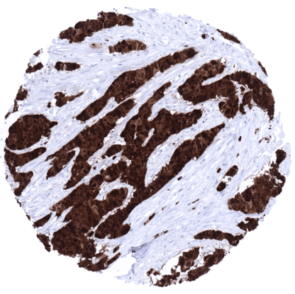 [sk1806] S100P (MSVA-480R)