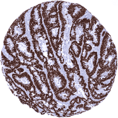 [sk1808] SATB2 (MSVA-702R)