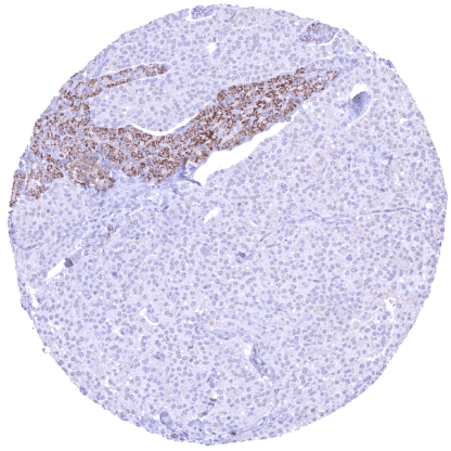 [sk1810] SDHA (HMV336)