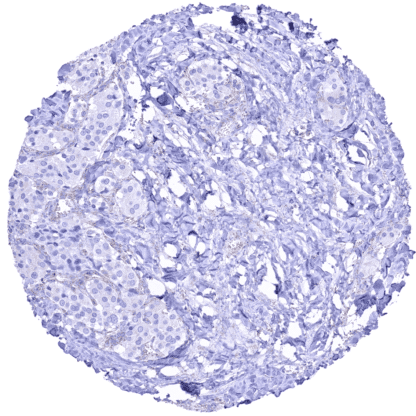 [sk1813] SDHB (HMV320)