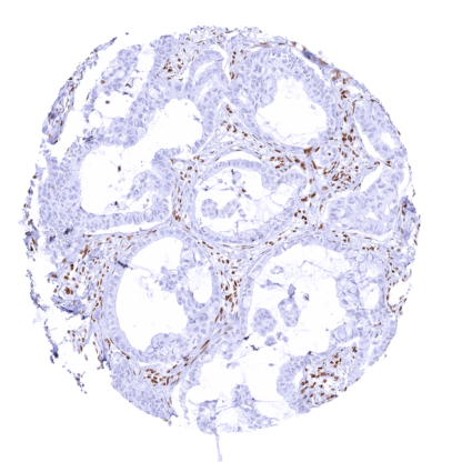 [sk1821] SMARCA4 / BRG1 (MSVA-397R)