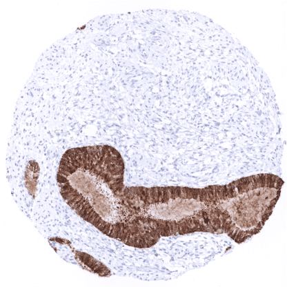 Mammaglobin (MSVA-457R)