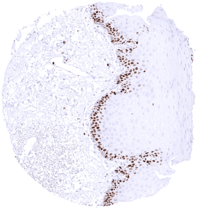 [sk1651] MCM5 (MSVA-505R)