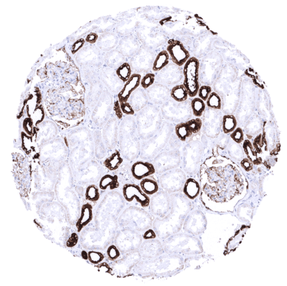 [sk1685] MUC1 / EMA (MSVA-672R)
