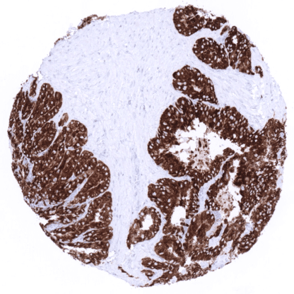 [sk1692] MUC6 (MSVA-806R)