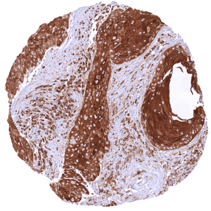 [sk1697] MX1 / Myxovirus resistance protein 1 (HMV316)