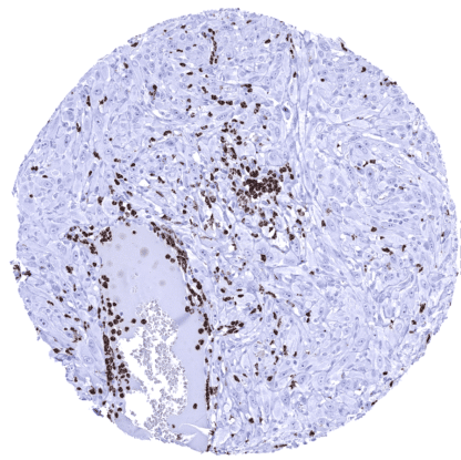 [sk1701] Myeloperoxidase / MPO (MSVA-692M)