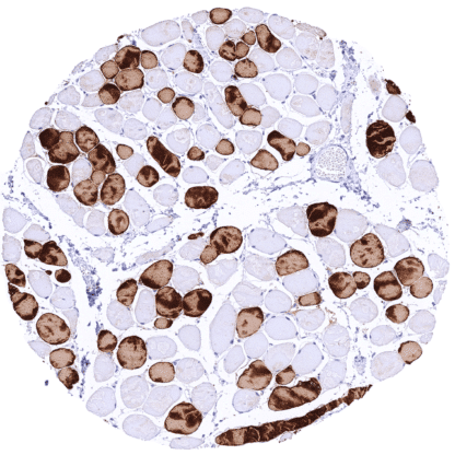 [sk1708] MYH7 / Myosin Heavy Chain 7 (MSVA-464M)