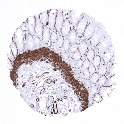 [sk1711] Myosin Heavy Chain 11 (MSVA-375R)