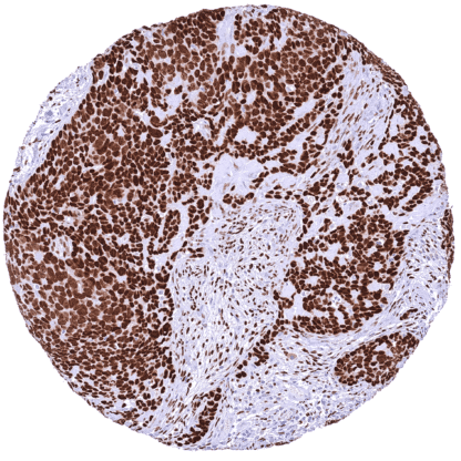 [sk1718] NFIX (HMV329)