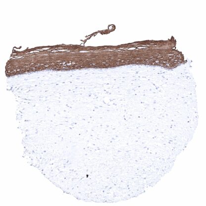 [sk1443] Cytokeratin 6 (MSVA-606R)