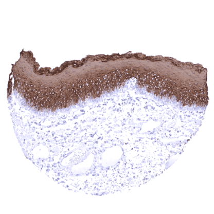 [sk1451] Cytokeratin 13 (MSVA-613M)