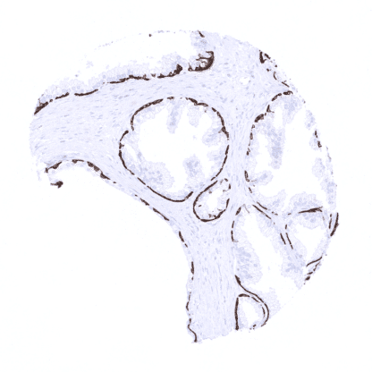 [sk1455] Cytokeratin 14 (MSVA-614R)
