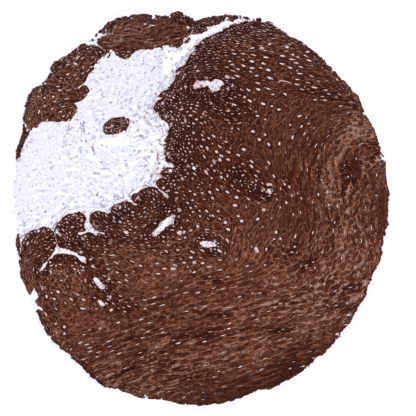 [sk1457] Cytokeratin 15 (MSVA-615M)