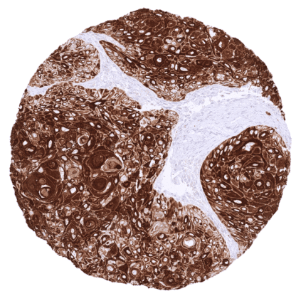 [sk1459] Cytokeratin 17 (MSVA-117R)