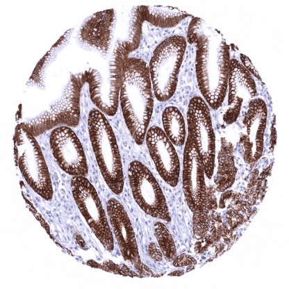 [sk1462] Cytokeratin 18 (MSVA-118R)