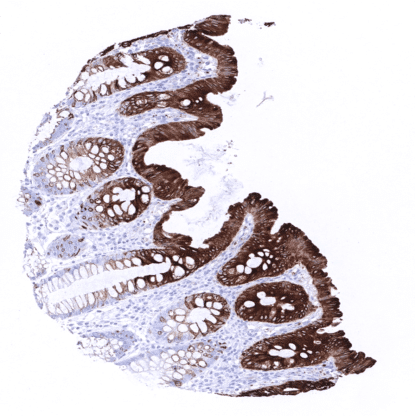 [sk1468] Cytokeratin 20 (MSVA-620R)