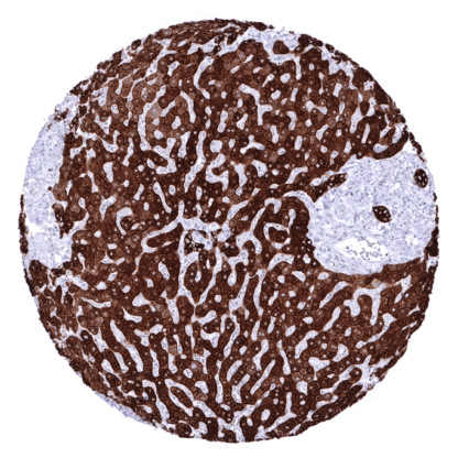 [sk1472] Cytokeratin, Pan (MSVA-000R)