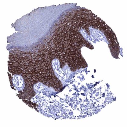 [sk1487] Desmoglein 1 (MSVA-544M)