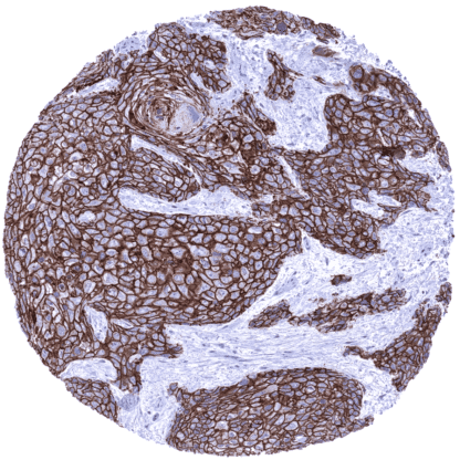 [sk1490] Desmoglein 3 (MSVA-543M)