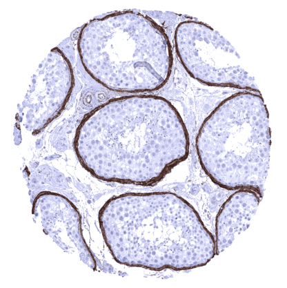 [sk1499] Elastin (MSVA-648R)