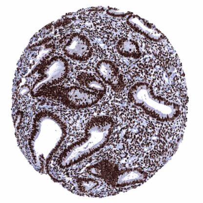 [sk1505] Estrogen Receptor (MSVA-564R)