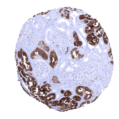 [sk1509] FABP1 (MSVA-501M)