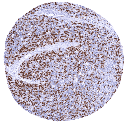 [sk1886] Tyrosine Hydroxylase / TH (HMV312)