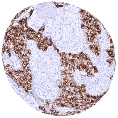 [sk1887] Tyrosine Hydroxylase / TH (HMV312)