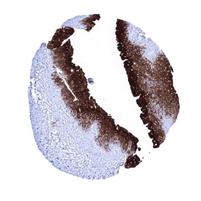 [sk1890] Uroplakin 1A (MSVA-735M)